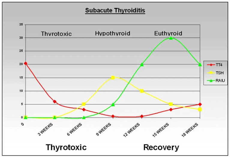 Subacute thyroiditis graph with lab tests over time
